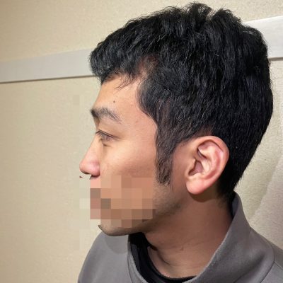 池田 恭平 画像